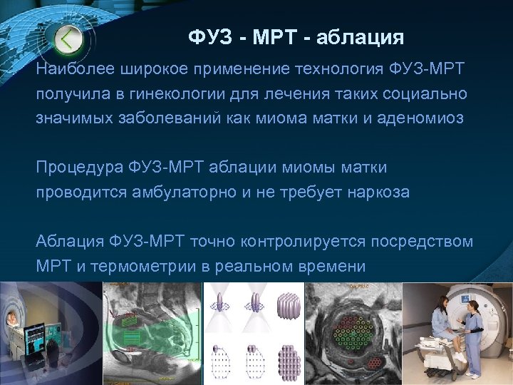ФУЗ - МРТ - аблация Наиболее широкое применение технология ФУЗ-МРТ получила в гинекологии для