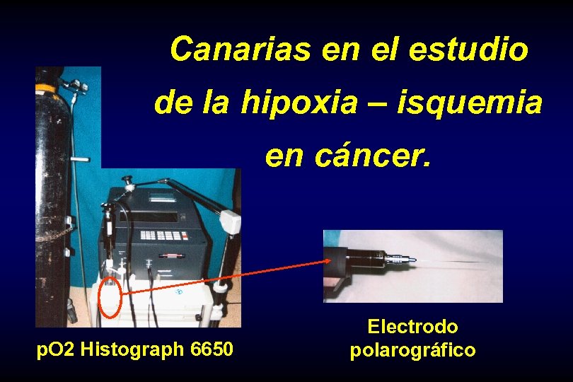 Canarias en el estudio de la hipoxia – isquemia en cáncer. p. O 2