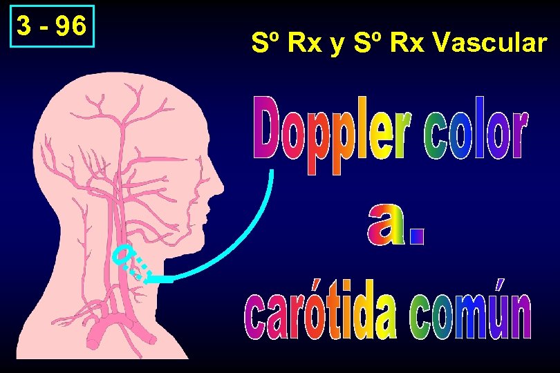 3 - 96 Sº Rx y Sº Rx Vascular 