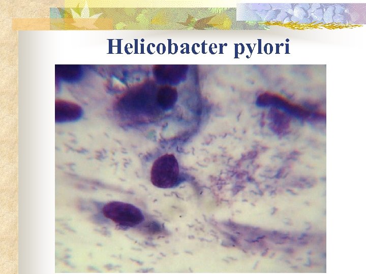 Helicobacter pylori 