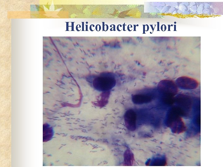 Helicobacter pylori 