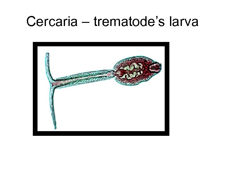 Cercaria – trematode’s larva 