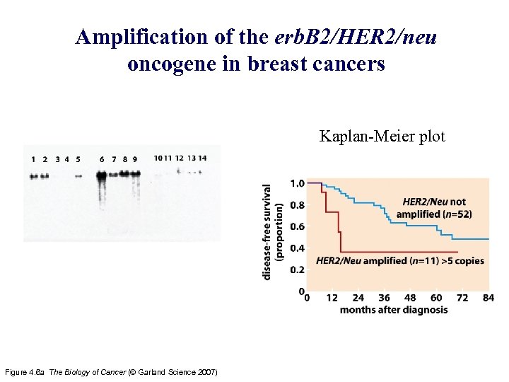 Amplification of the erb. B 2/HER 2/neu oncogene in breast cancers Kaplan-Meier plot Figure