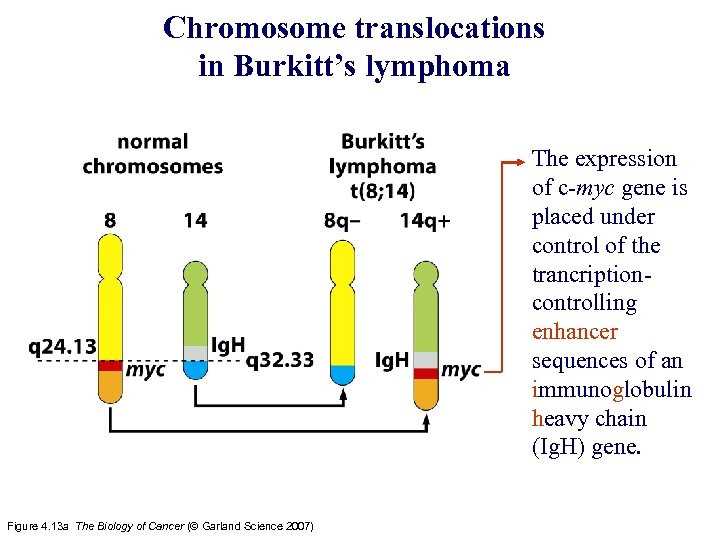 Chromosome translocations in Burkitt’s lymphoma The expression of c-myc gene is placed under control