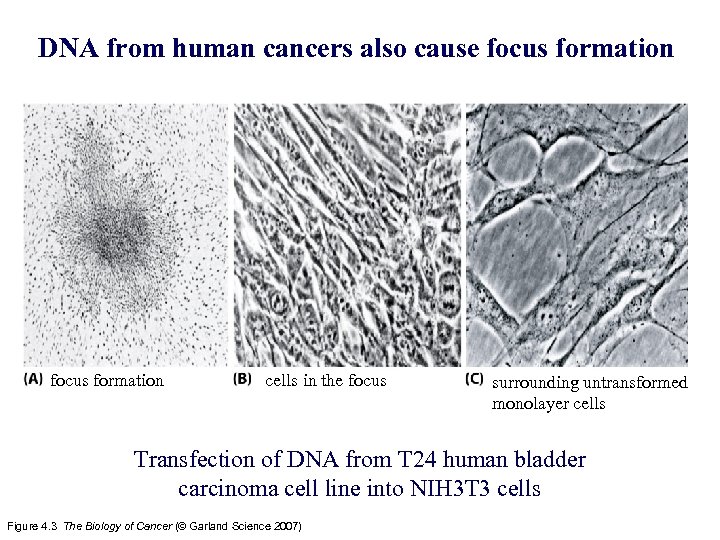 DNA from human cancers also cause focus formation cells in the focus surrounding untransformed