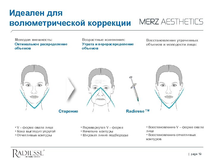 Идеален для волюметрической коррекции Молодая внешность: Оптимальное распределение объемов Старение • V – форма