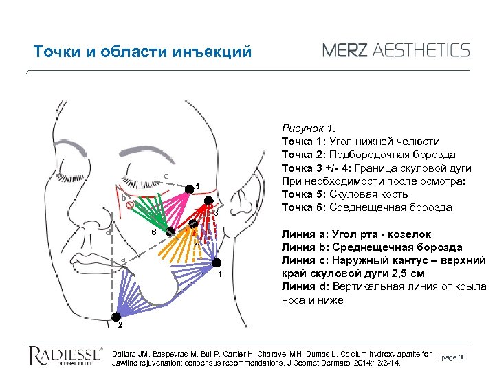 Точки и области инъекций C 5 b 3 d 6 4 a 1 Рисунок