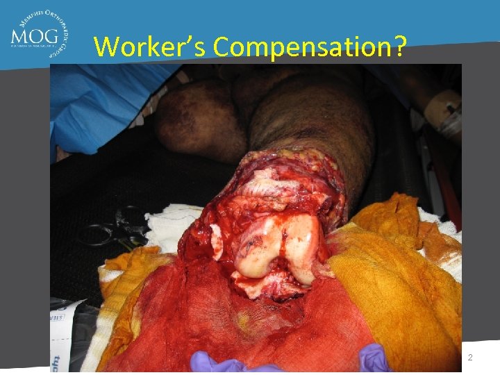 Worker’s Compensation? 2 