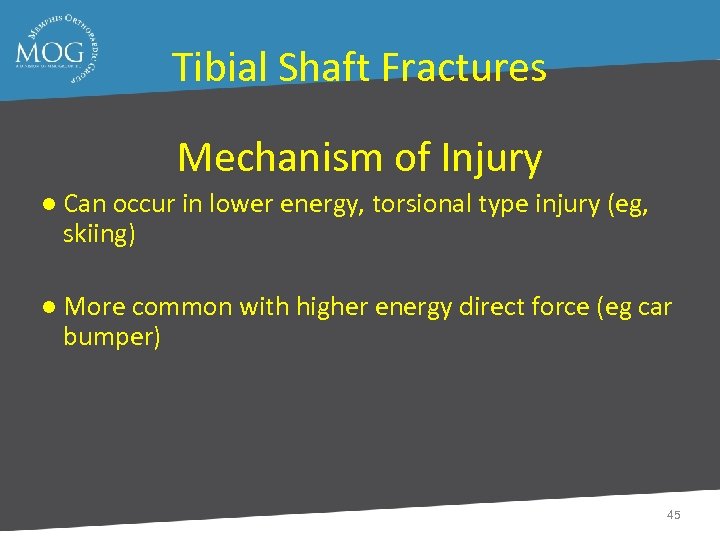 Tibial Shaft Fractures Mechanism of Injury ● Can occur in lower energy, torsional type