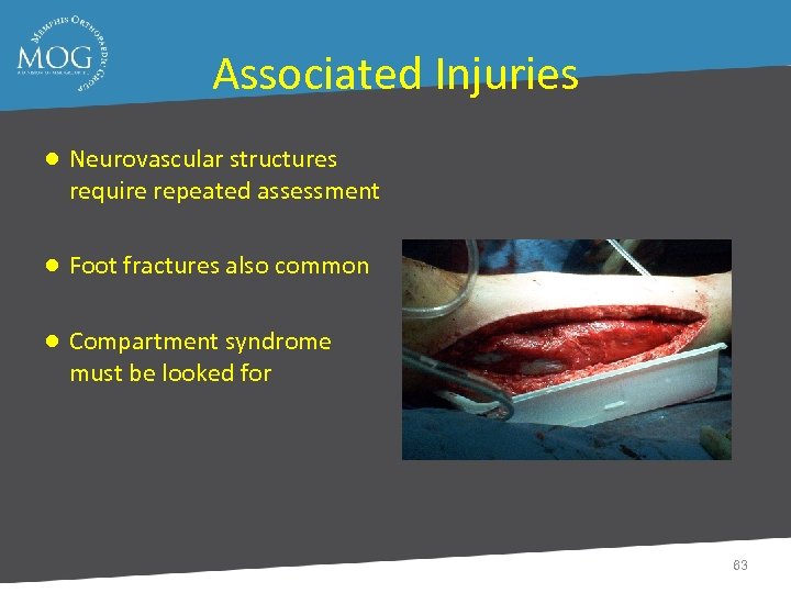 Associated Injuries ● Neurovascular structures require repeated assessment ● Foot fractures also common ●