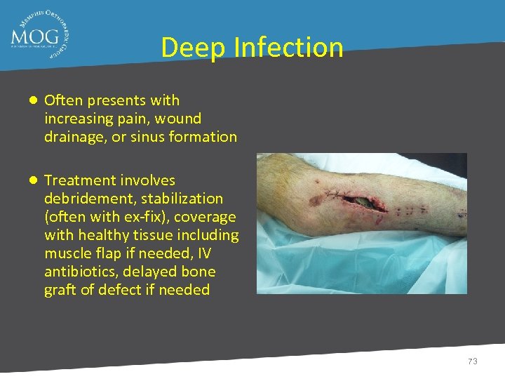 Deep Infection ● Often presents with increasing pain, wound drainage, or sinus formation ●