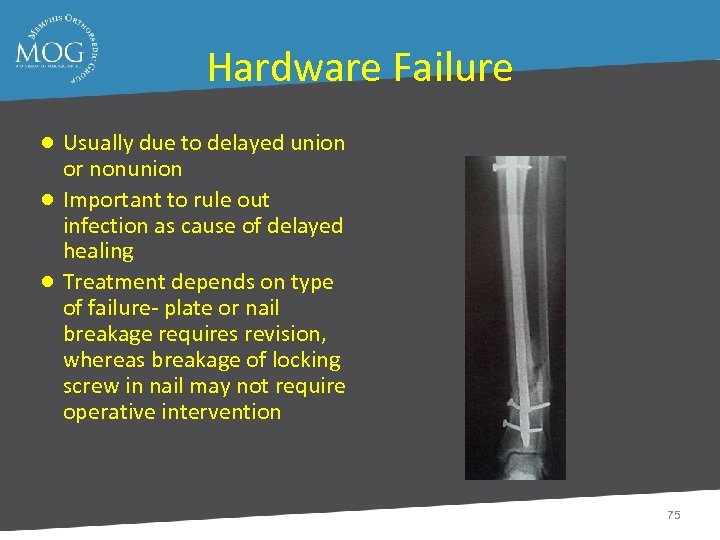 Hardware Failure ● Usually due to delayed union or nonunion ● Important to rule