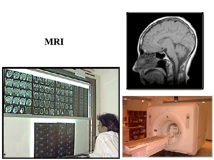 MRI 