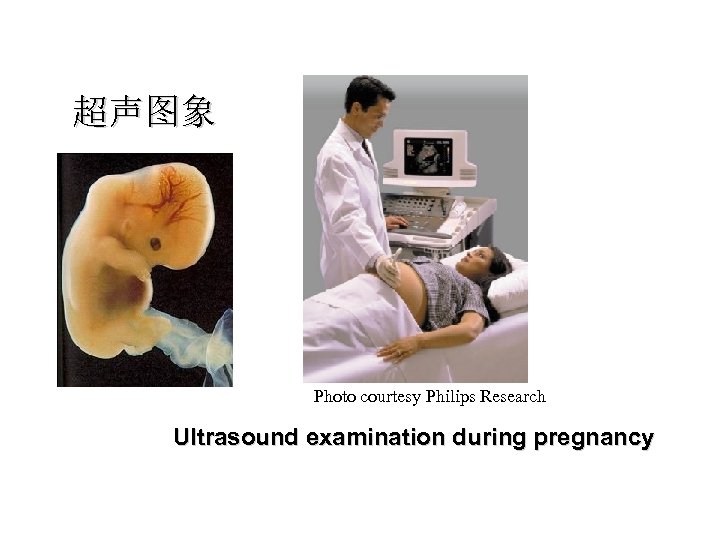 超声图象 Photo courtesy Philips Research Ultrasound examination during pregnancy 