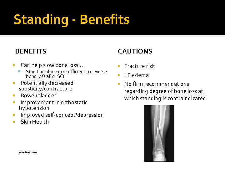 Standing - Benefits BENEFITS Can help slow bone loss…. Standing alone not sufficient to