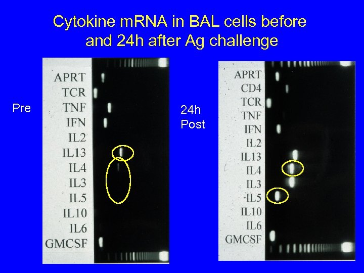 Cytokine m. RNA in BAL cells before and 24 h after Ag challenge Pre