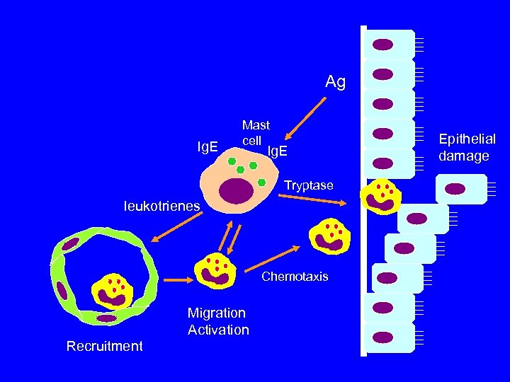 Ag Ig. E Mast cell Ig. E Tryptase leukotrienes Chemotaxis Migration Activation Recruitment Epithelial