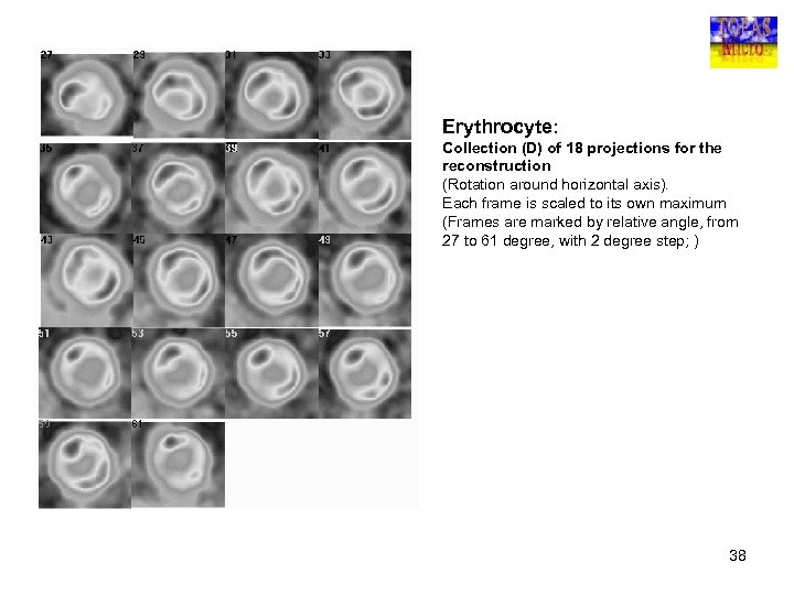 Erythrocyte: Collection (D) of 18 projections for the reconstruction (Rotation around horizontal axis). Each