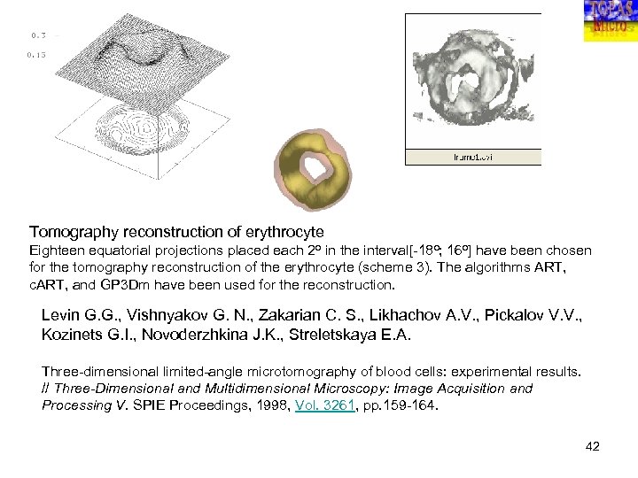 Tomography reconstruction of erythrocyte Eighteen equatorial projections placed each 2 o in the interval[-18