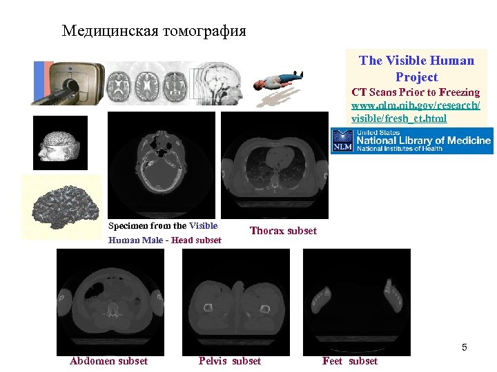 Медицинская томография The Visible Human Project CT Scans Prior to Freezing www. nlm. nih.