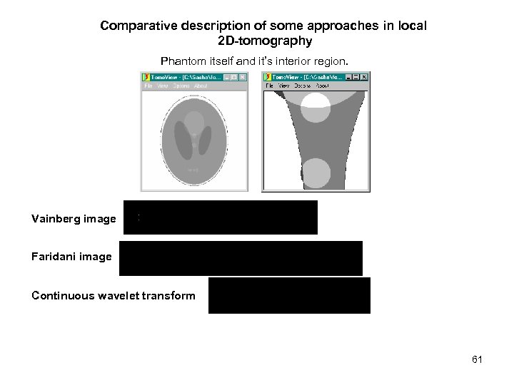 Comparative description of some approaches in local 2 D-tomography Phantom itself and it’s interior