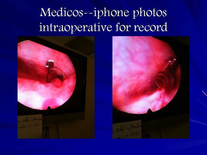 Medicos--iphone photos intraoperative for record 