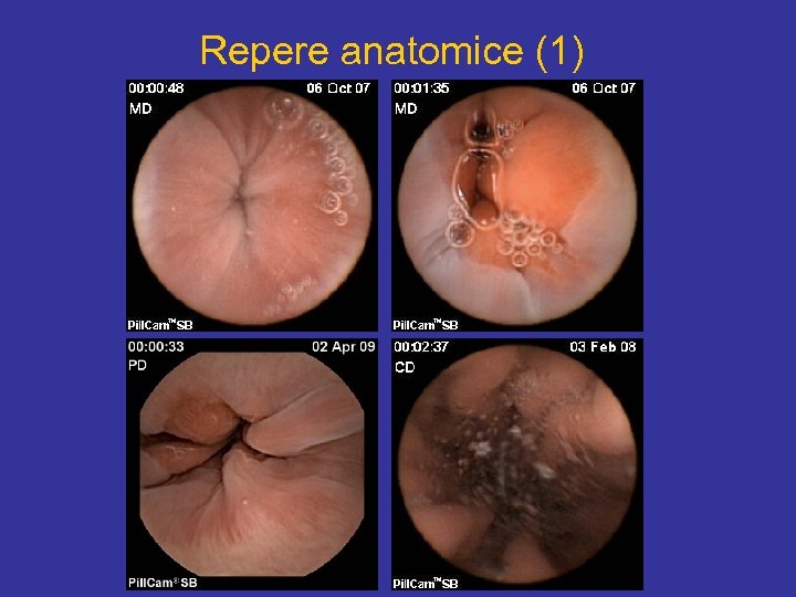Repere anatomice (1) 