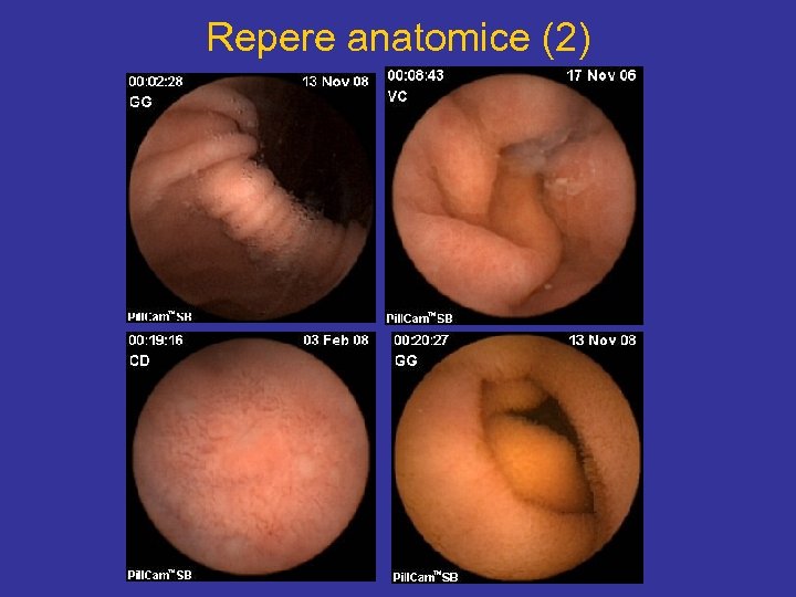 Repere anatomice (2) 