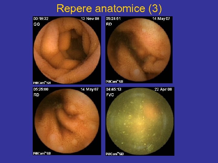 Repere anatomice (3) 