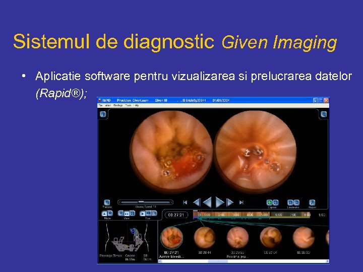 Sistemul de diagnostic Given Imaging • Aplicatie software pentru vizualizarea si prelucrarea datelor (Rapid®);