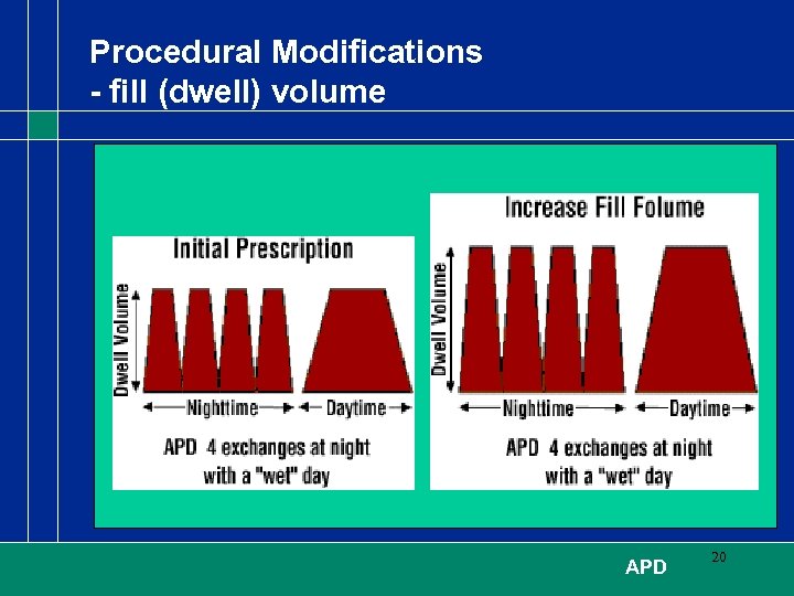 Procedural Modifications - fill (dwell) volume APD 20 