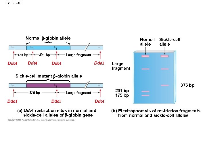 Fig. 20 -10 Normal -globin allele 175 bp Dde. I Sickle-cell allele Large fragment