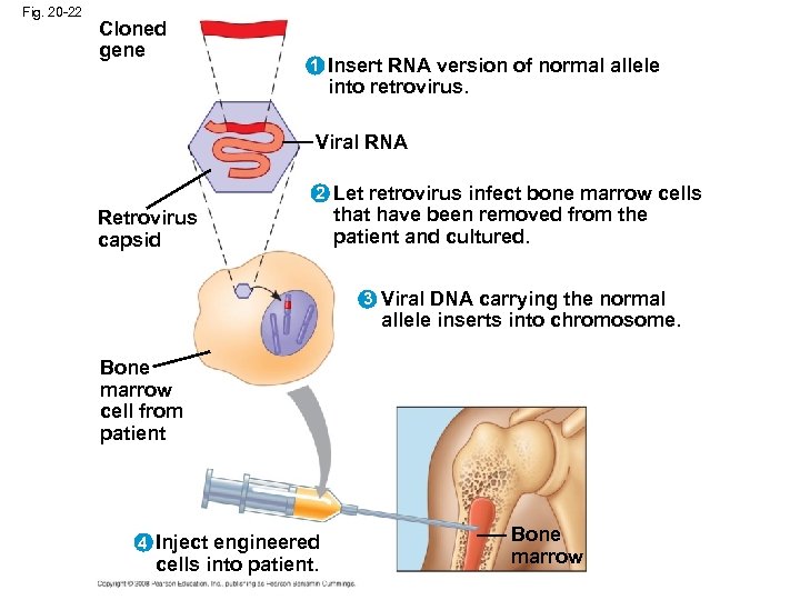 Fig. 20 -22 Cloned gene 1 Insert RNA version of normal allele into retrovirus.