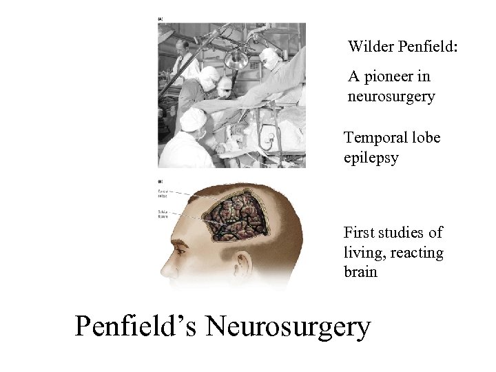 Wilder Penfield: A pioneer in neurosurgery Temporal lobe epilepsy First studies of living, reacting