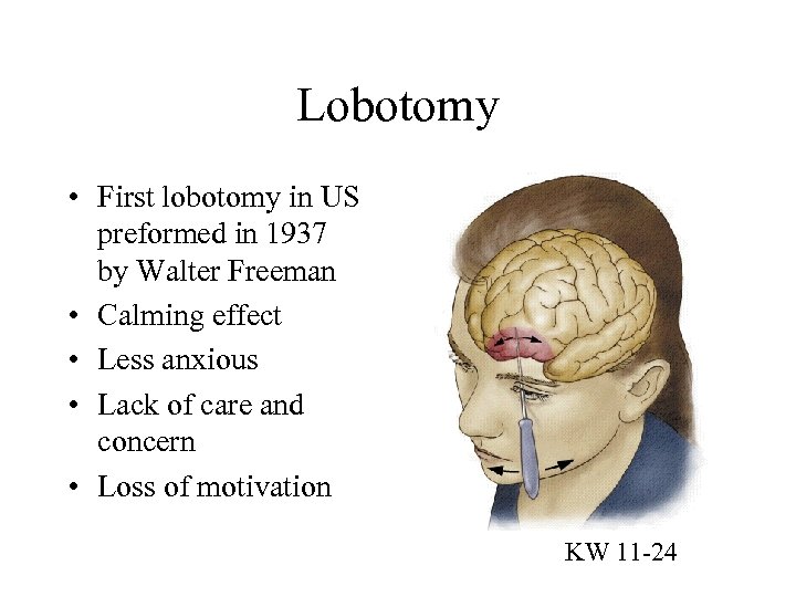 Lobotomy • First lobotomy in US preformed in 1937 by Walter Freeman • Calming