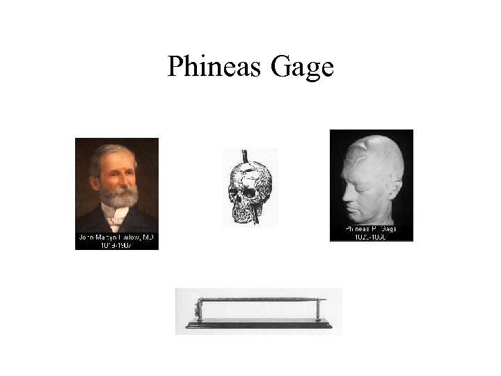 Phineas Gage 