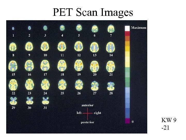 PET Scan Images KW 9 -21 