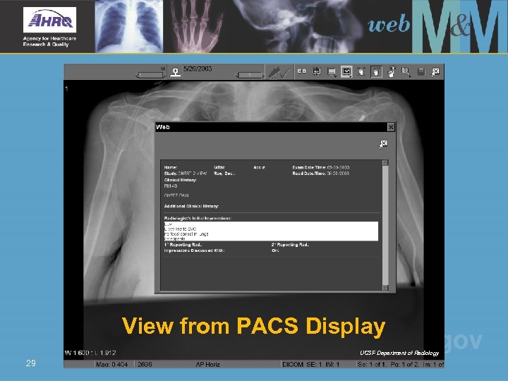 View from PACS Display UCSF Department of Radiology 29 