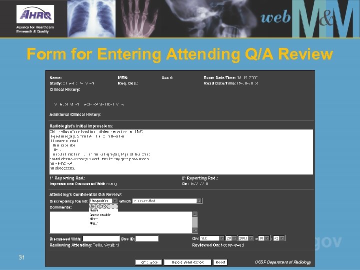 Form for Entering Attending Q/A Review 31 UCSF Department of Radiology 