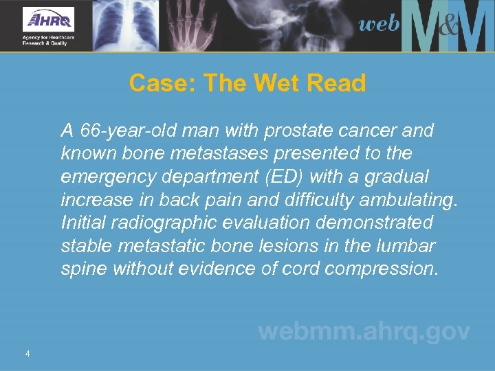 Case: The Wet Read A 66 -year-old man with prostate cancer and known bone