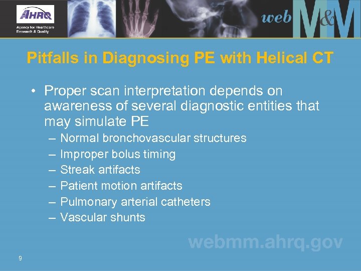 Pitfalls in Diagnosing PE with Helical CT • Proper scan interpretation depends on awareness