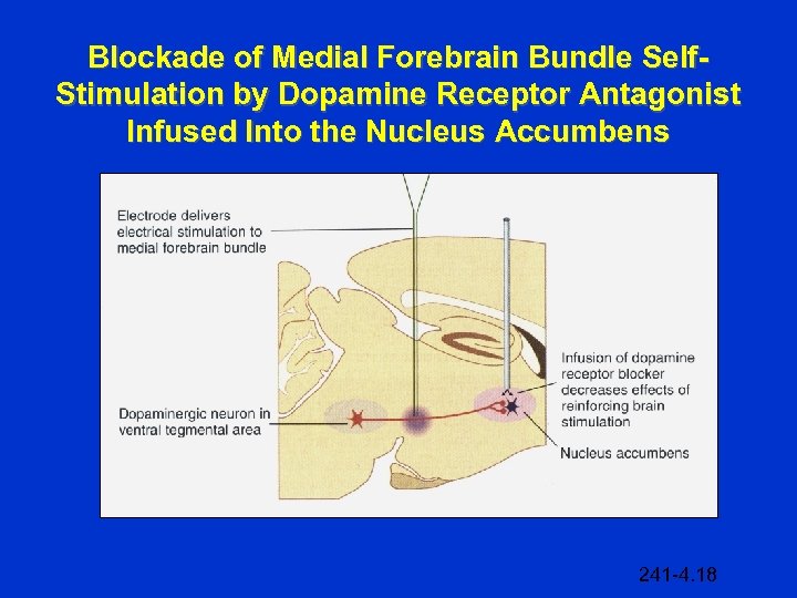 Blockade of Medial Forebrain Bundle Self. Stimulation by Dopamine Receptor Antagonist Infused Into the