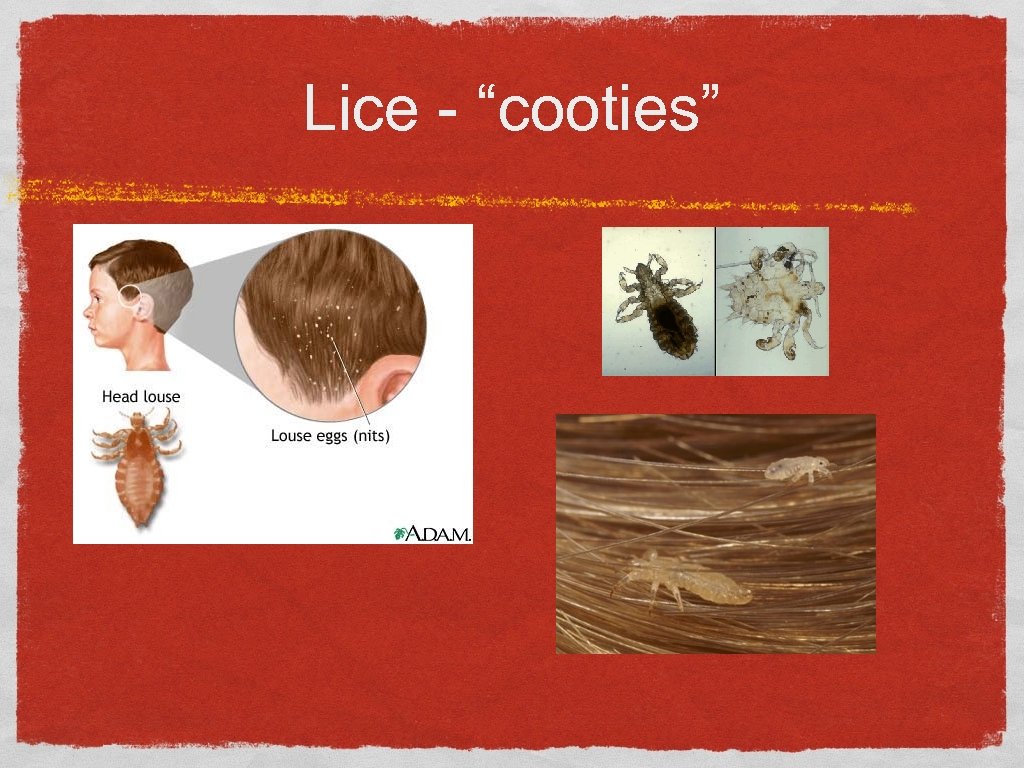 Lice - “cooties” 