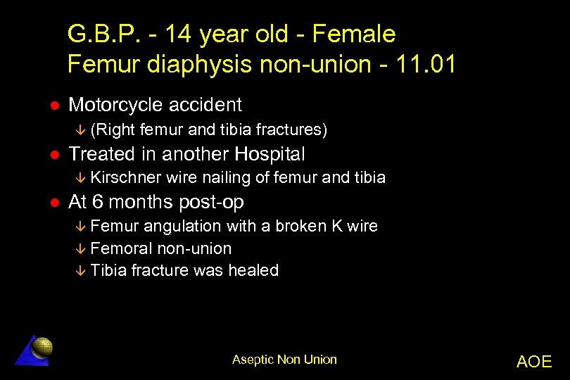 G. B. P. - 14 year old - Female Femur diaphysis non-union - 11.