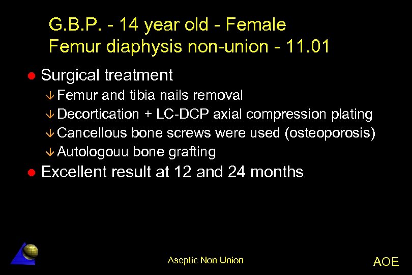 G. B. P. - 14 year old - Female Femur diaphysis non-union - 11.