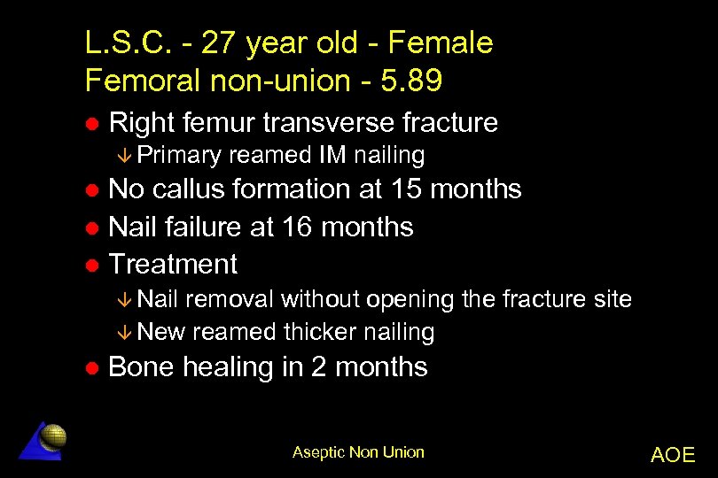 L. S. C. - 27 year old - Female Femoral non-union - 5. 89