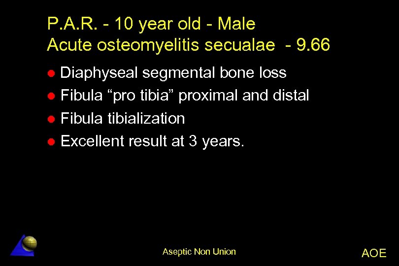 P. A. R. - 10 year old - Male Acute osteomyelitis secualae - 9.