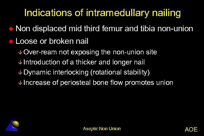 Indications of intramedullary nailing l Non displaced mid third femur and tibia non-union l