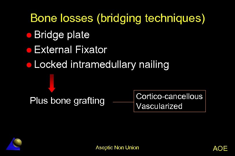 Bone losses (bridging techniques) l Bridge plate l External Fixator l Locked intramedullary nailing