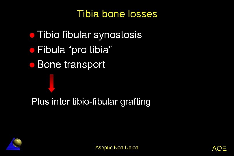 Tibia bone losses l Tibio fibular synostosis l Fibula “pro tibia” l Bone transport